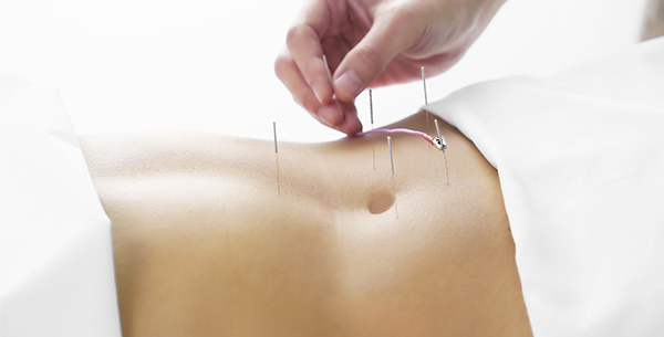 acupuncture at Chiva Som