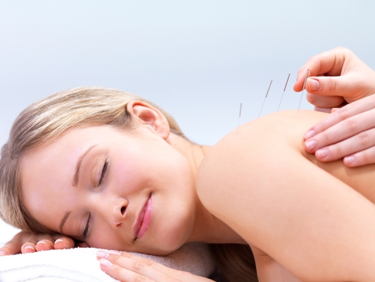 acupuncture back pain