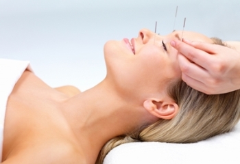 Acupuncture for facial work