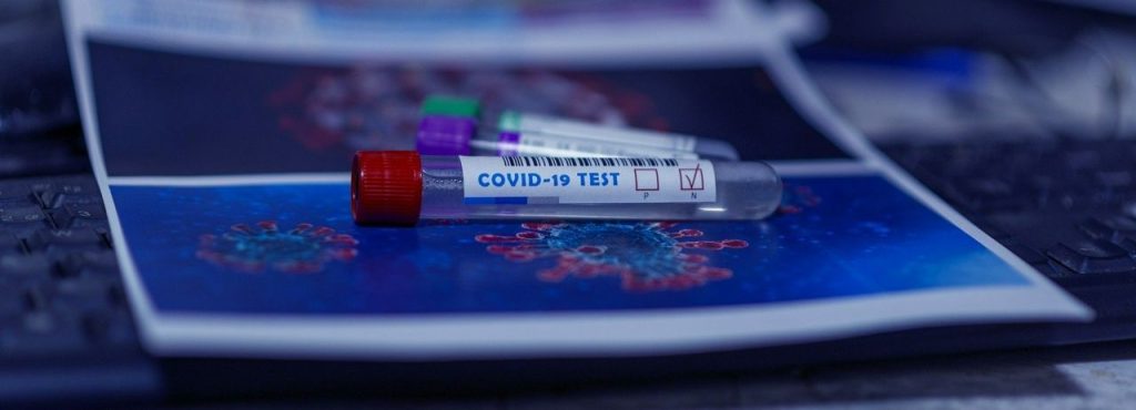 How to Get a COVID Test Abroad
