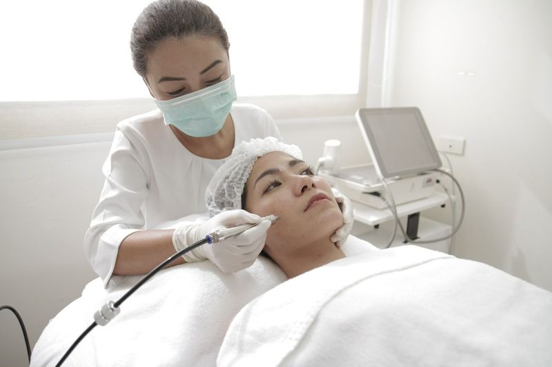Microdermabrasion